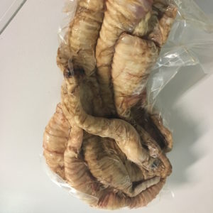 Trachea Trachea